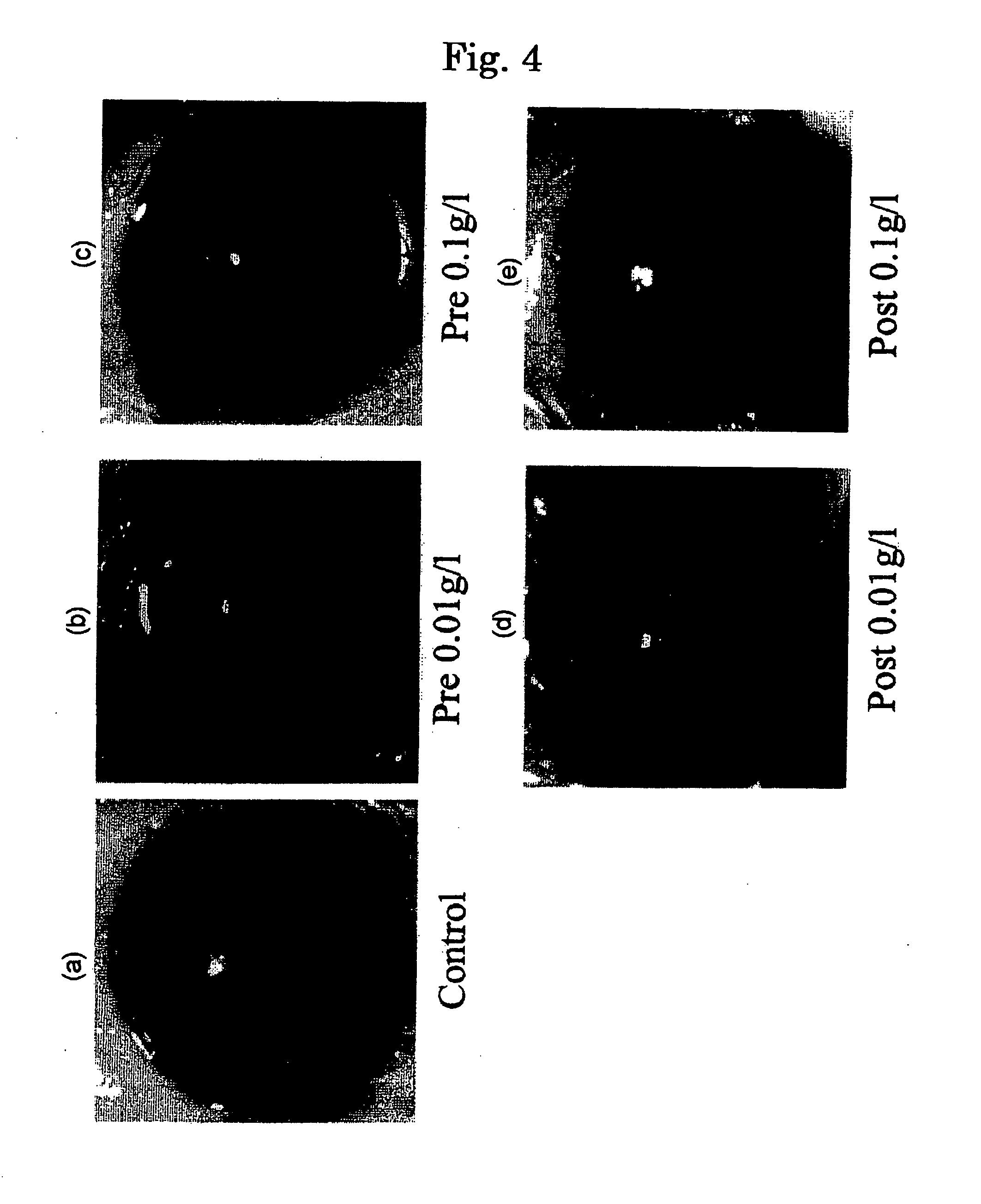 Agent for treating eye diseases