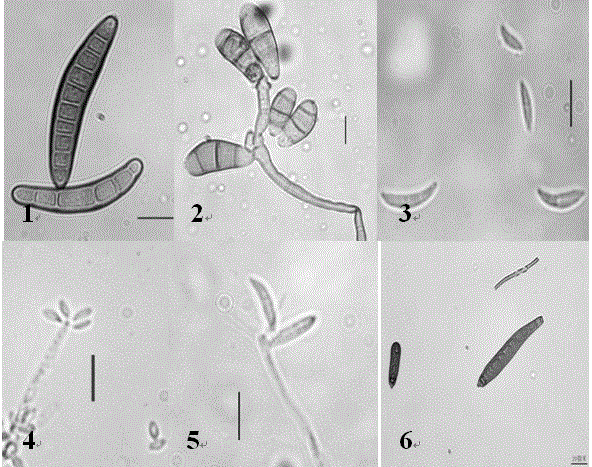 Method for detecting fungi carried by rice seeds by using improved rose Bengal culture medium