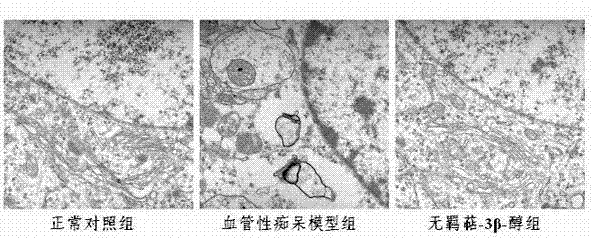 Application of friedelin-3 beta-alcohol to preparation of vascular dementia-resisting medicaments