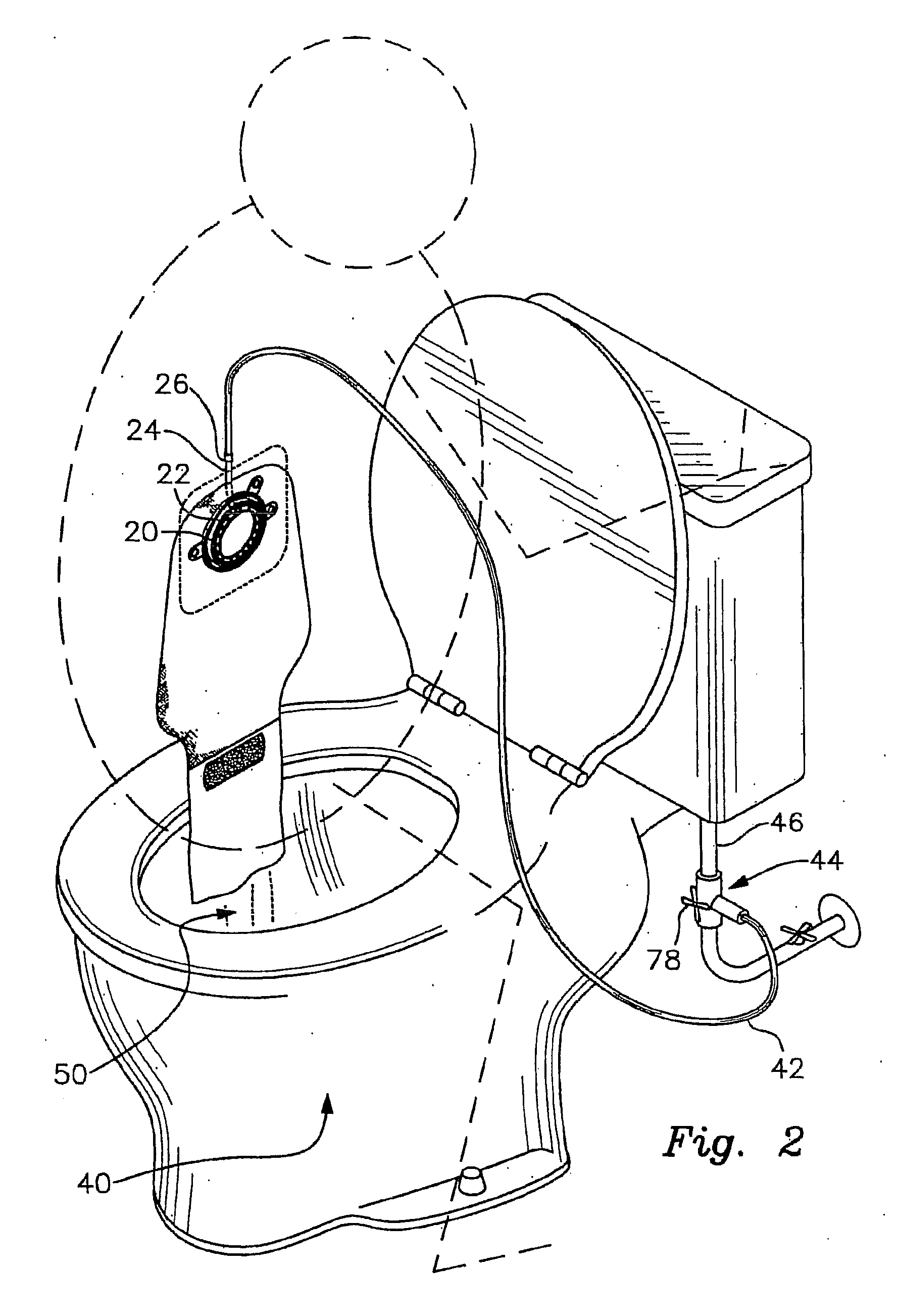 Colostomy bag cleaning system