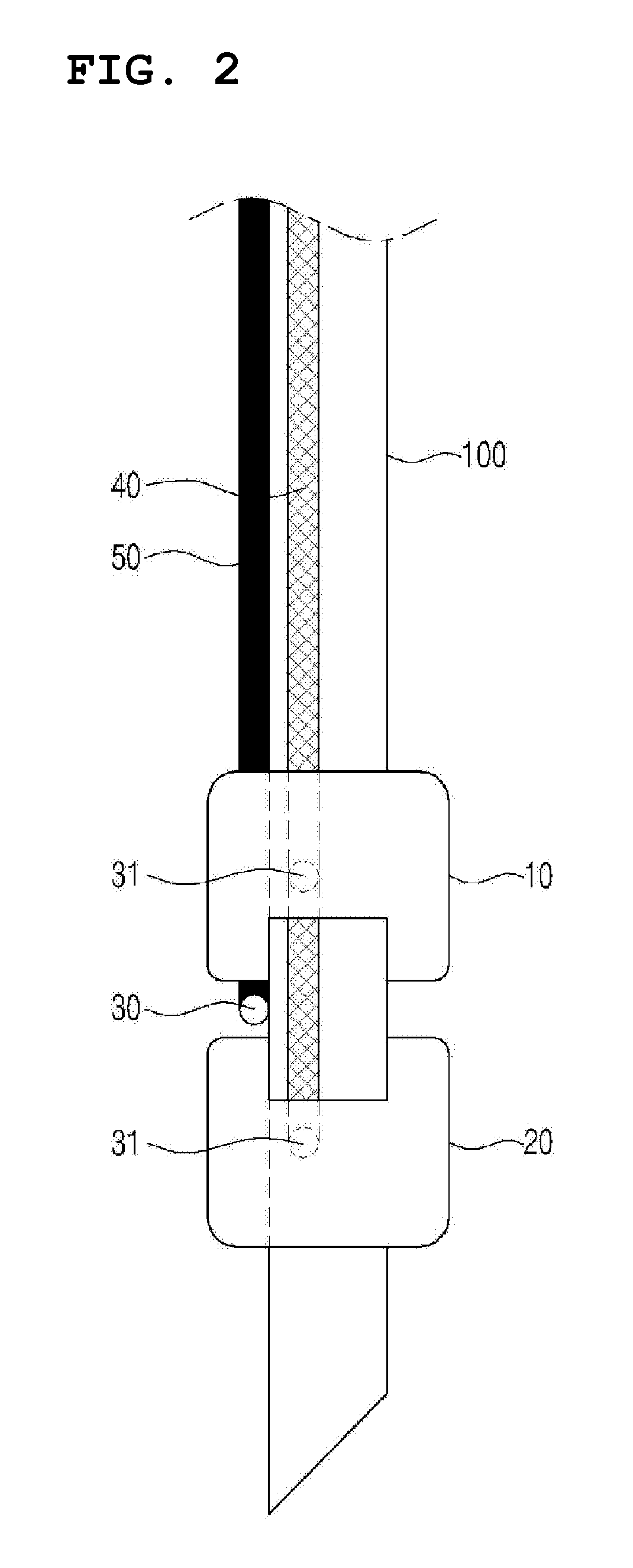 Tracheal tube comprising trachea sealing portion