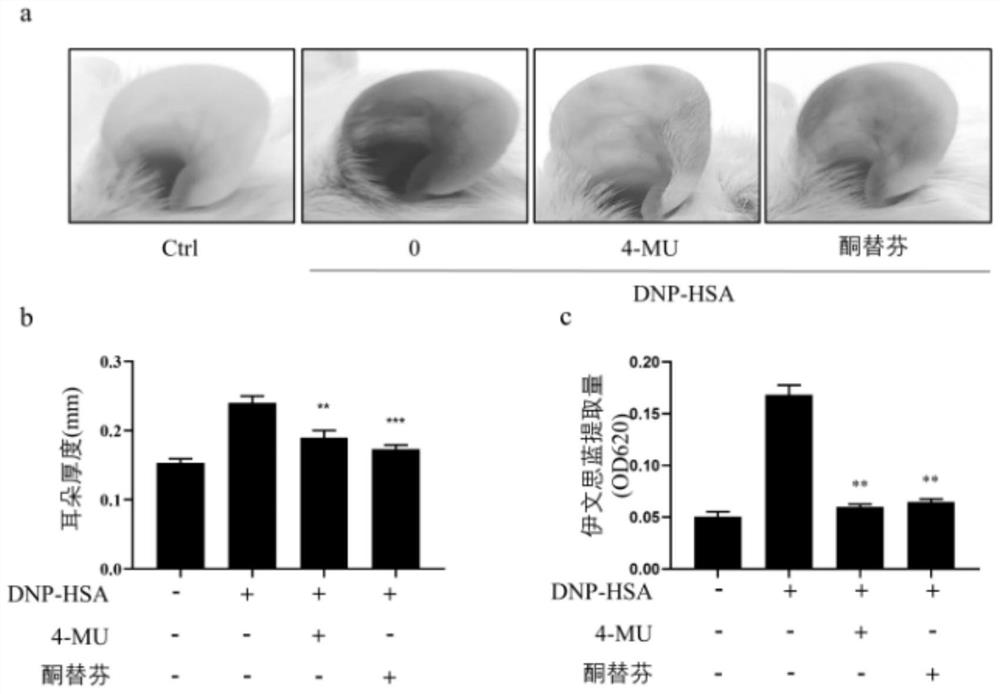 Application of 4-methylumbelliferone in preparation of anti-allergic drugs