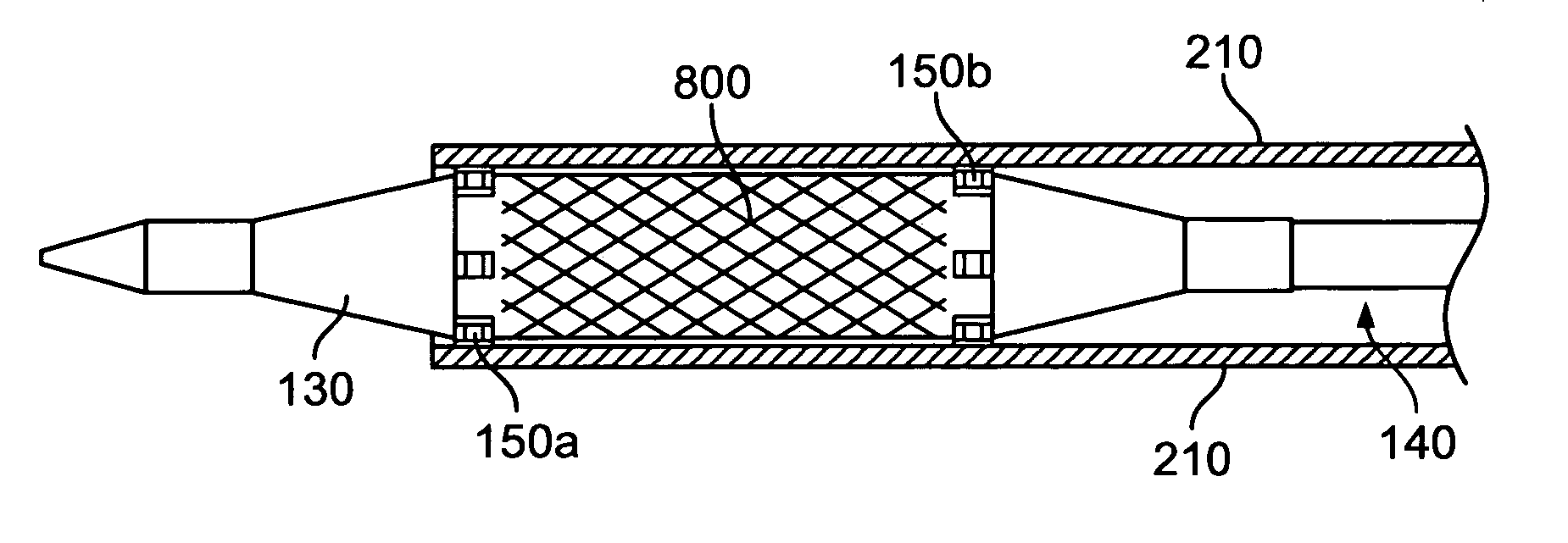 Balloon expandable platform with retaining features for a collapsible valve