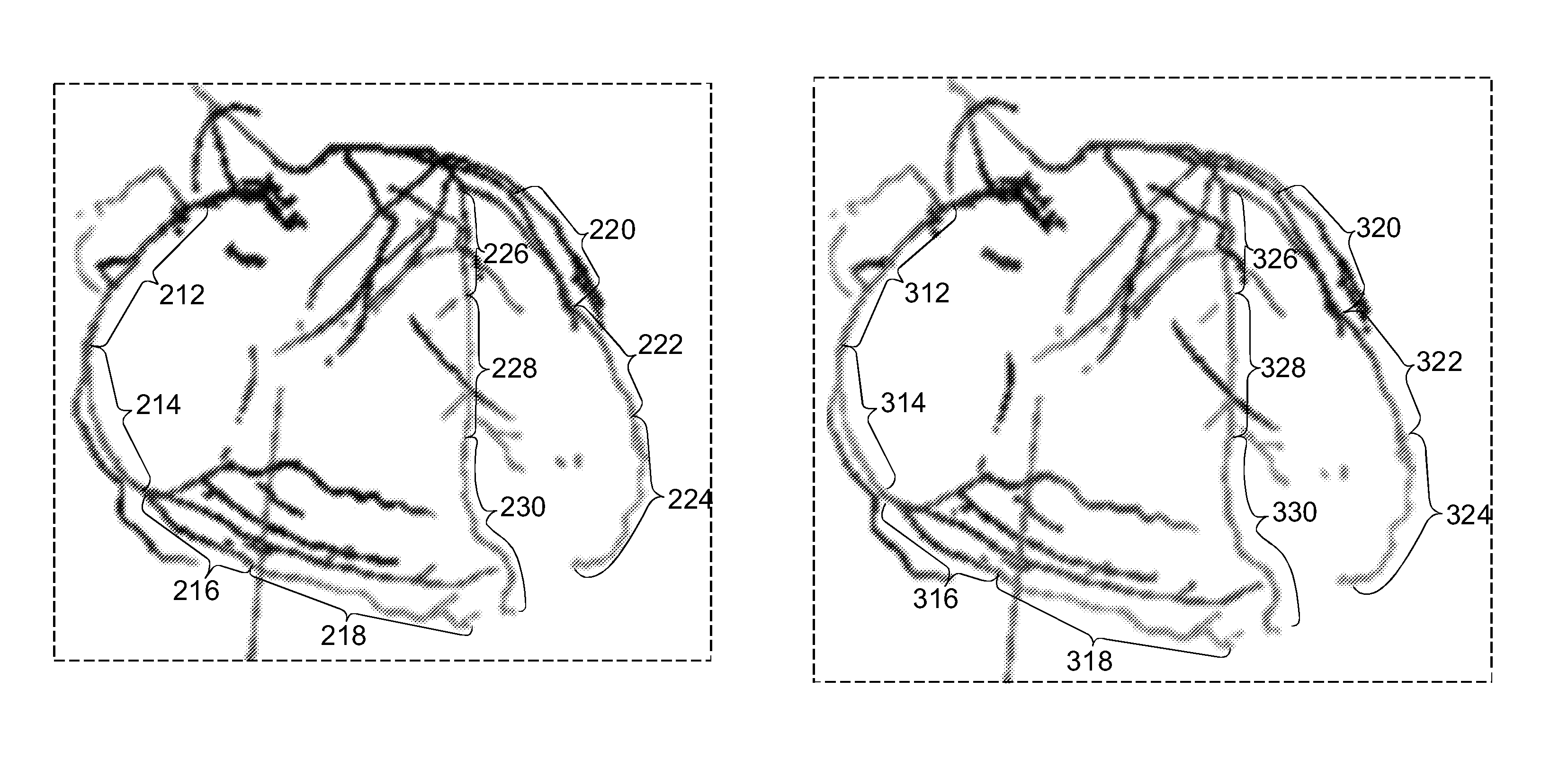 Visualization of the coronary artery tree