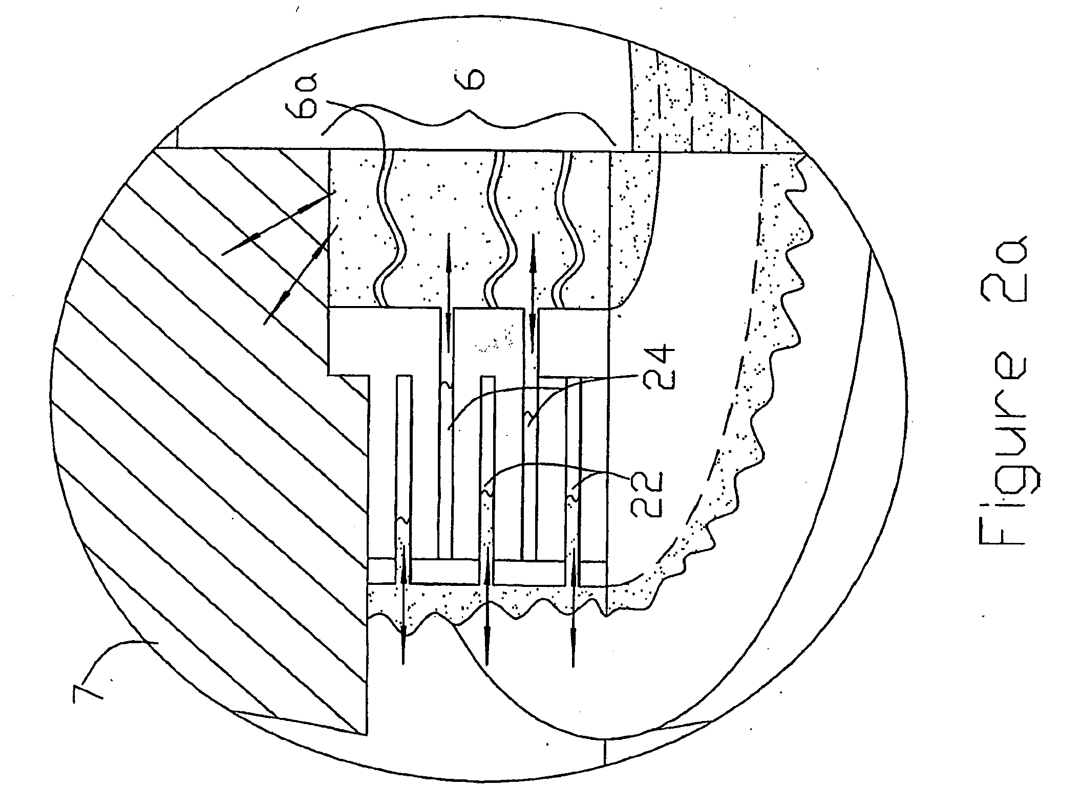 Intervertebral Prosthesis for Supporting Adjacent Vertebral Bodies Enabling the Creation of Soft Fusion and Method