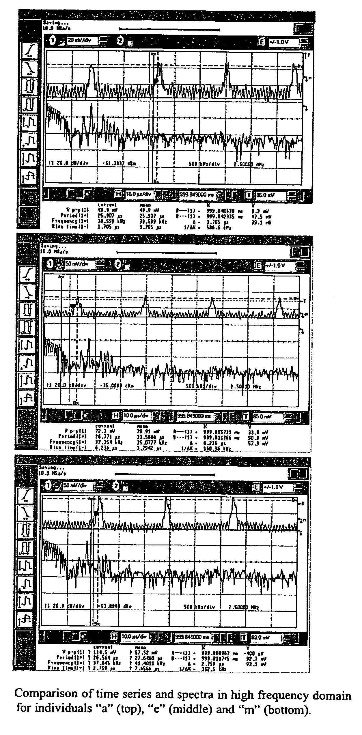 Individual quantitative identification by means of human dynamic rhythmic electric activity spectra