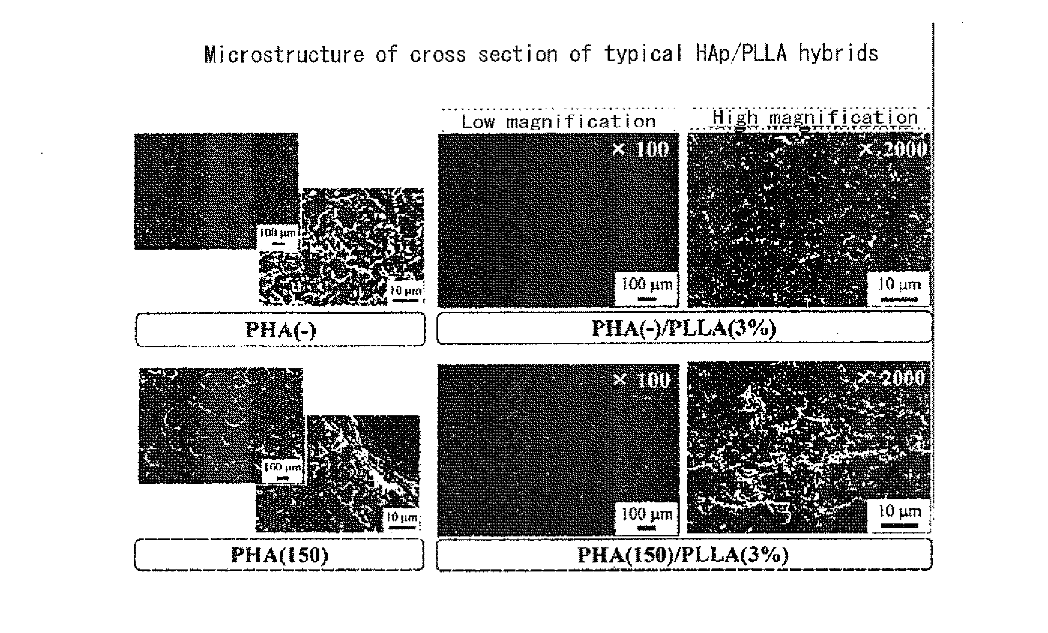 Biocompatible ceramic-polymer hybrids and calcium phosphate porous body