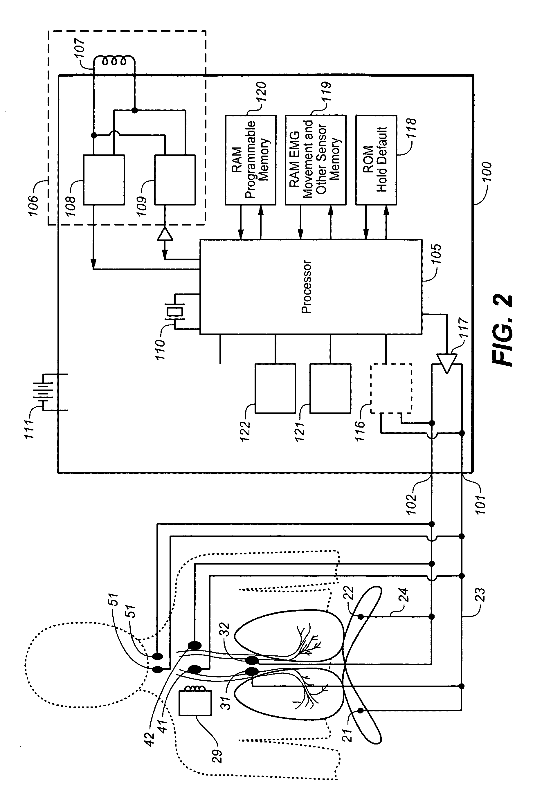 Therapeutic diaphragm stimulation device and method