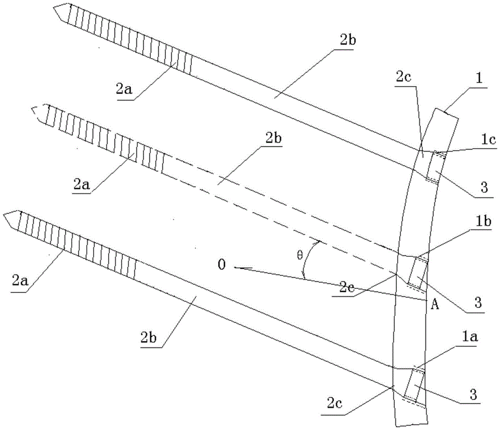 Dynamic compression locking plate for treatment of femoral neck fracture