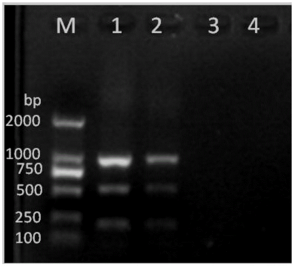 Detection primer group, detection kit, and detection method used for simultaneous detection of three pathogenic bacteria of marine fishes