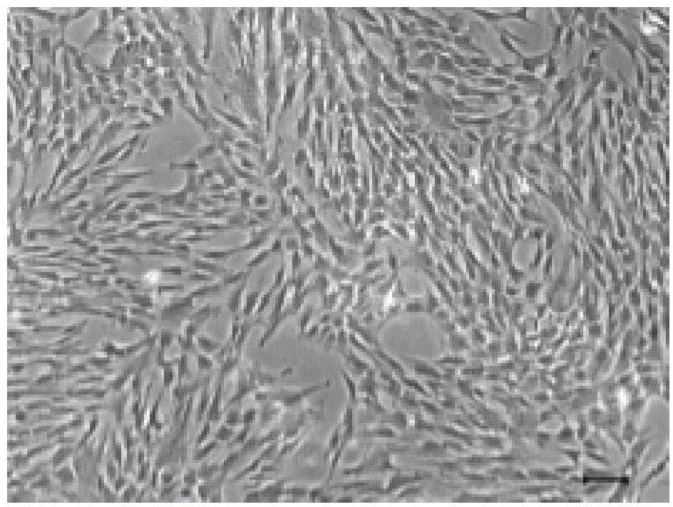 SFM (serum-free medium) for culturing MSCs (mesenchymal stem cells)