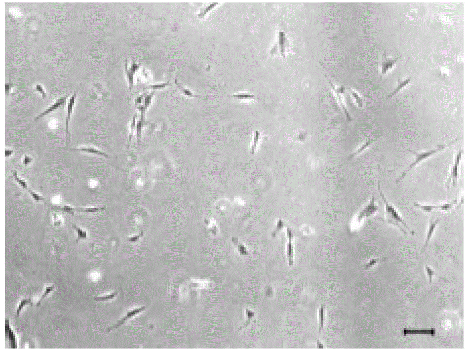 SFM (serum-free medium) for culturing MSCs (mesenchymal stem cells)