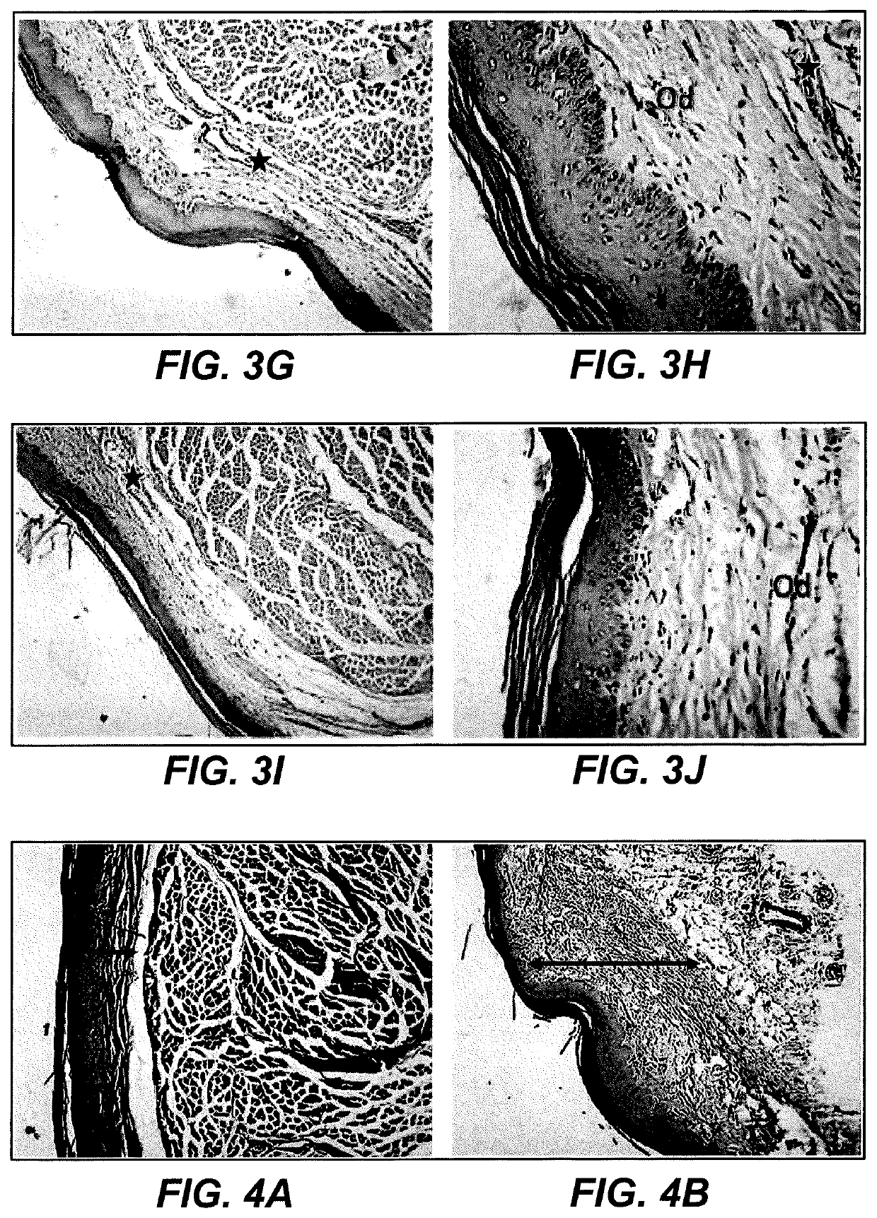 Method for treating inflammation