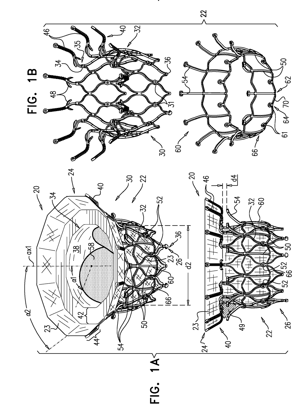 Prosthetic Heart Valve with Compressible Frames