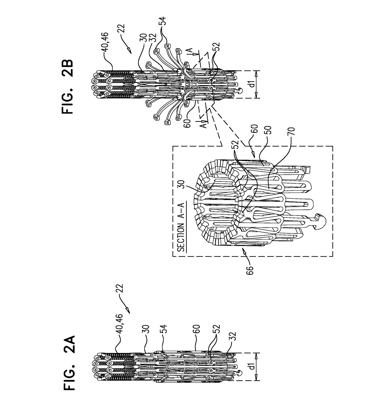 Prosthetic Heart Valve with Compressible Frames