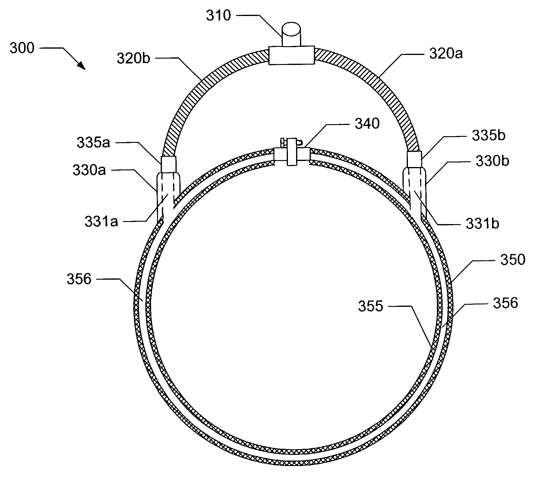 System and methods for reducing dust emissions