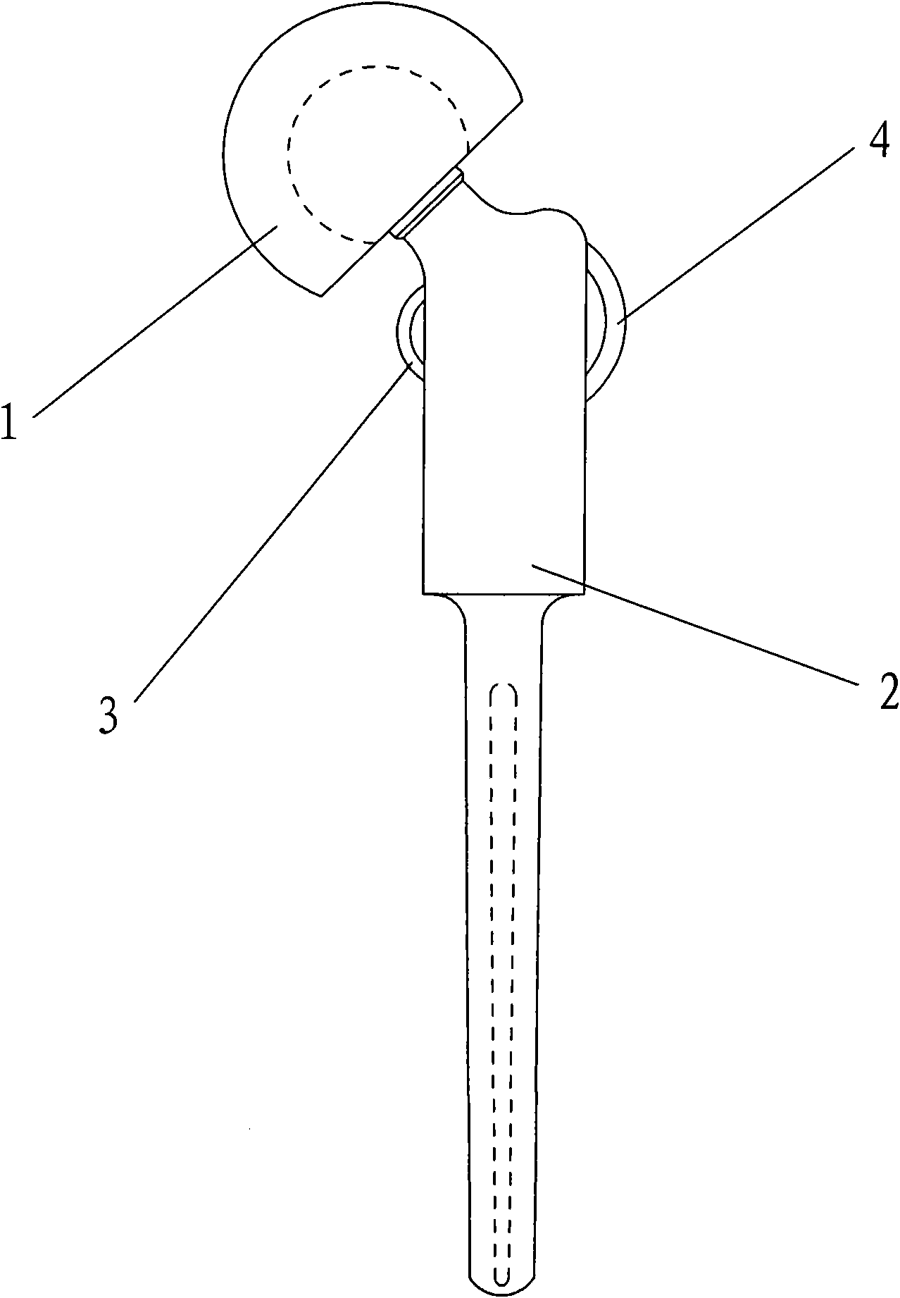 Femur upper segment hip-joint prosthesis