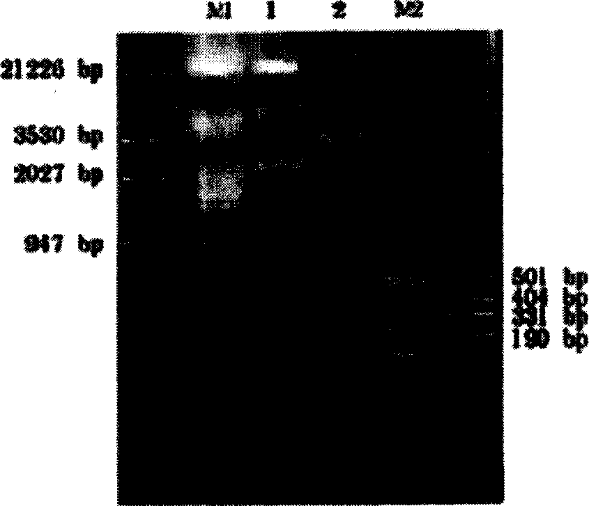 Method for preparing mB7.1-GPI fusion proteins and their uses