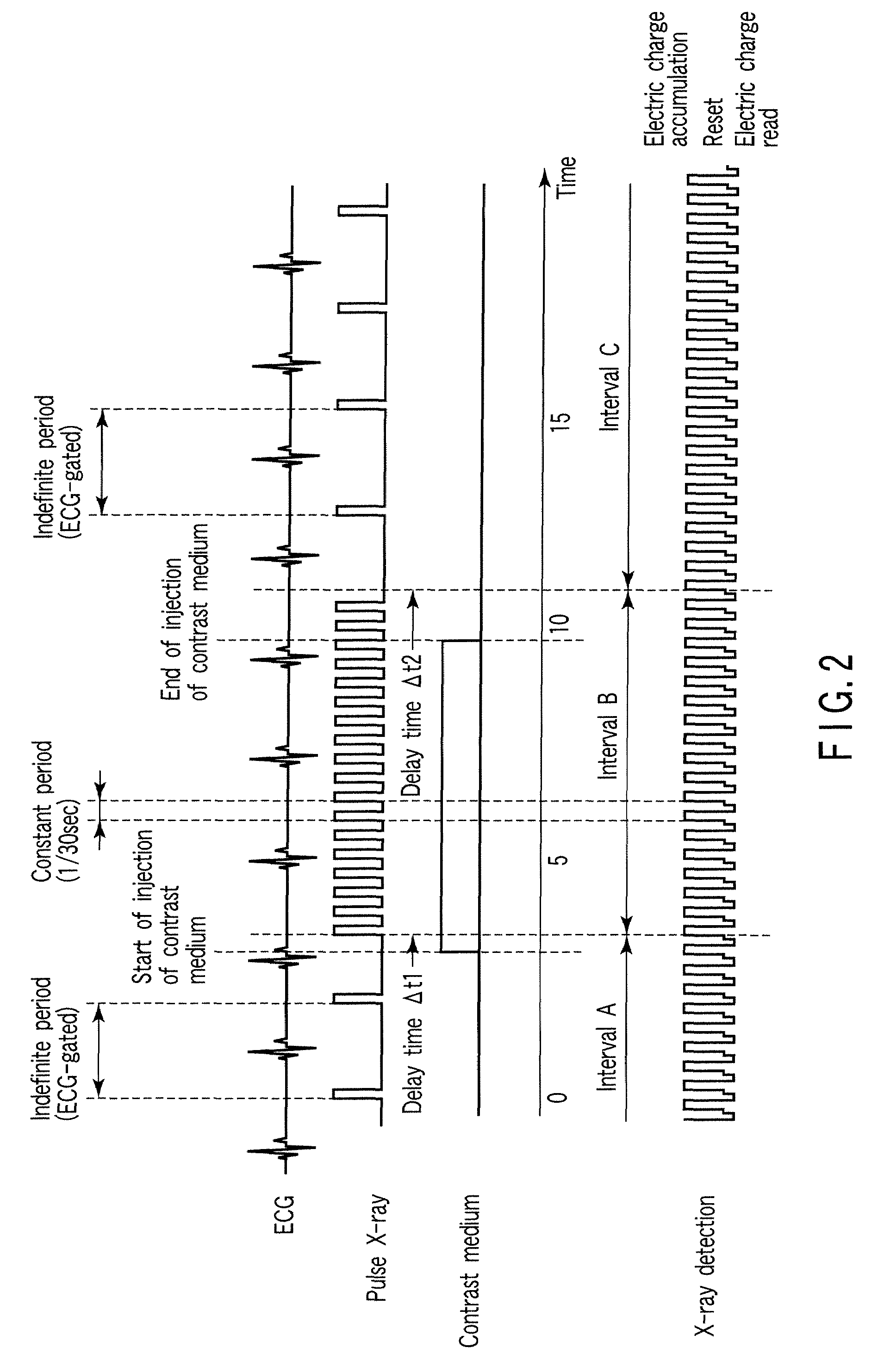 X-ray diagnostic apparatus and image processing apparatus