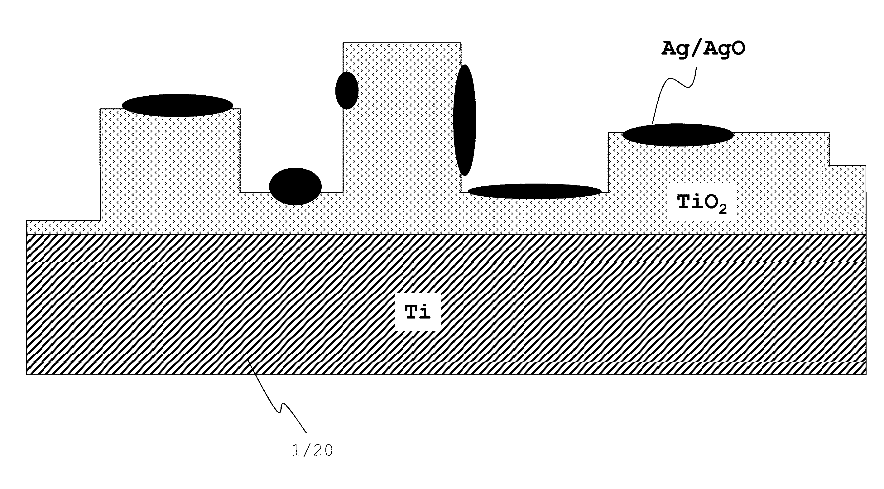 Osteosynthesis with nano-silver