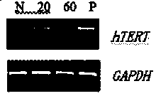 Preparation method of permanent cell line for multiplying orf virus