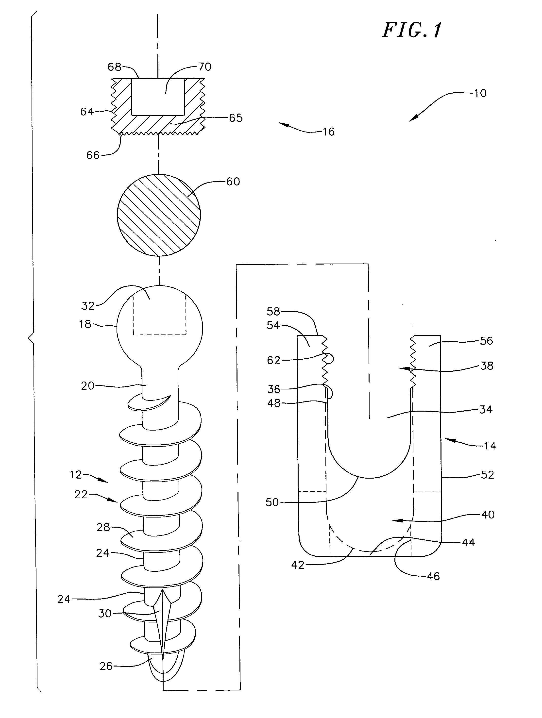 Low profile vertebral alignment and fixation assembly