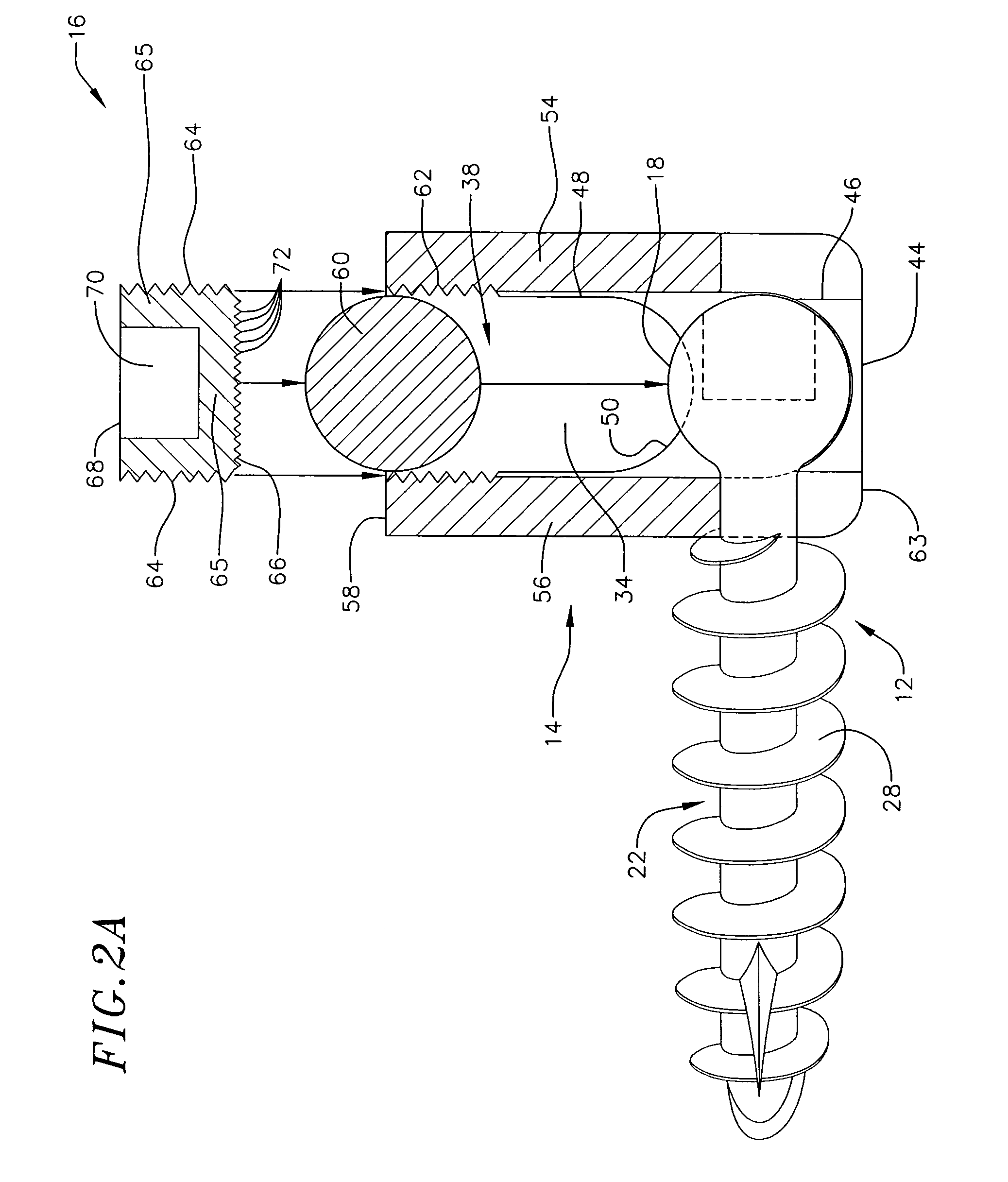 Low profile vertebral alignment and fixation assembly