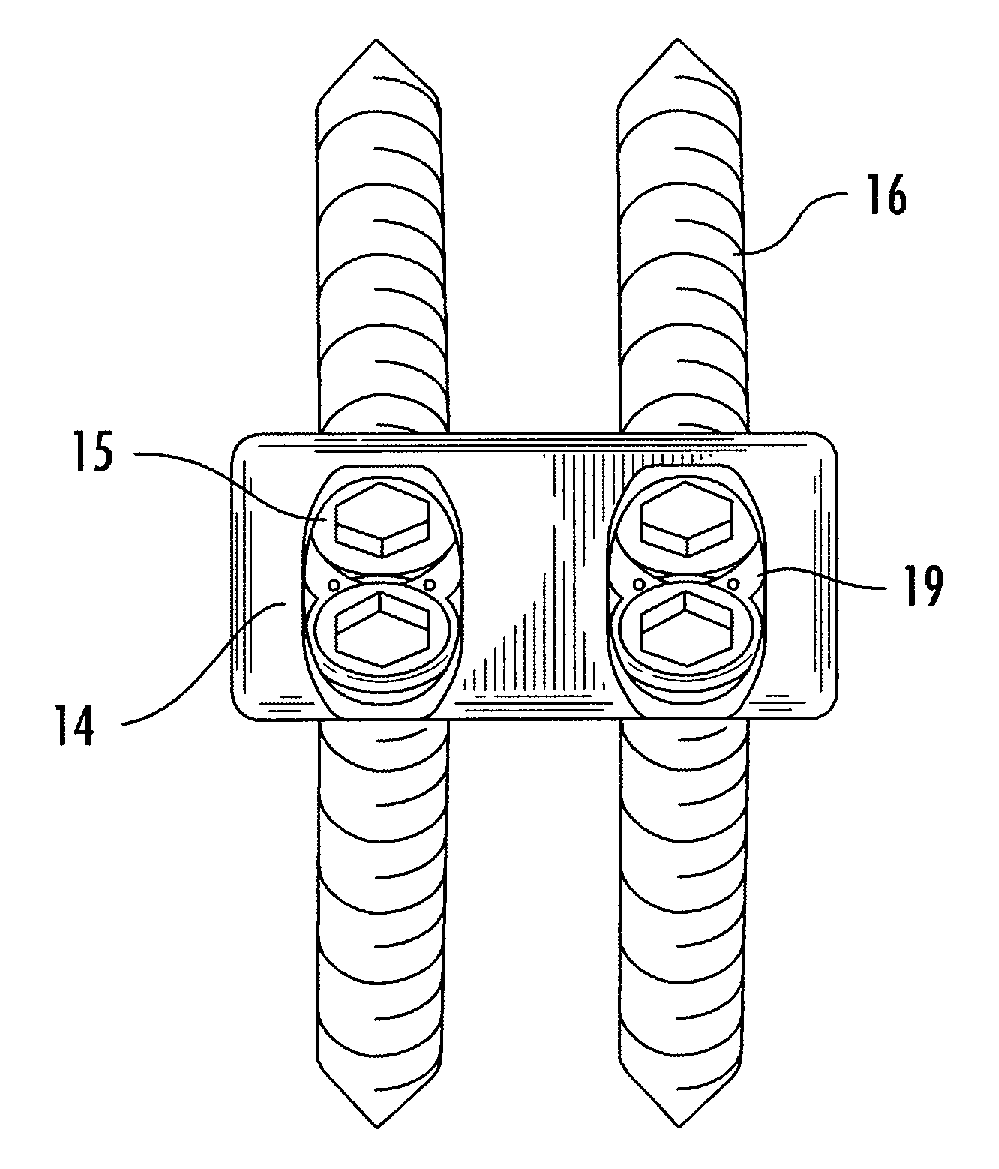 Interbody fusion system with intervertebral implant retention assembly