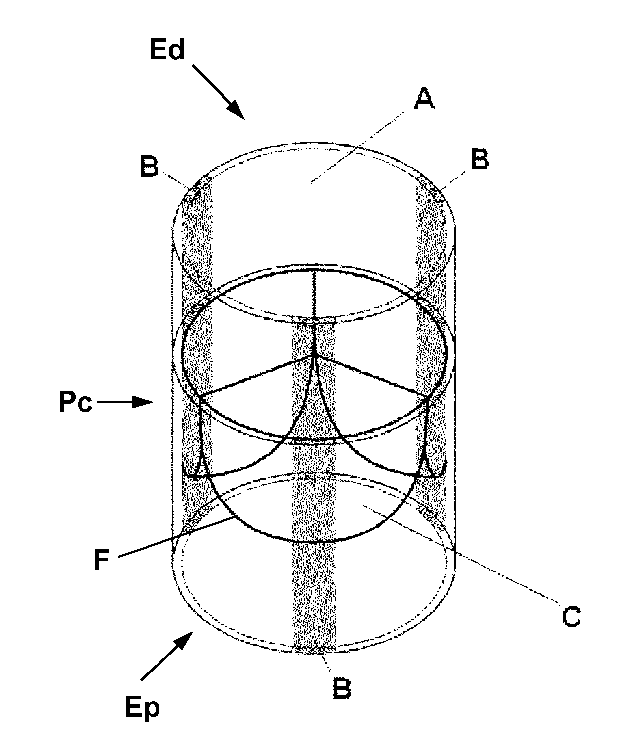 Biological heart valve replacement, particularly for pediatric patients, and manufacturing method