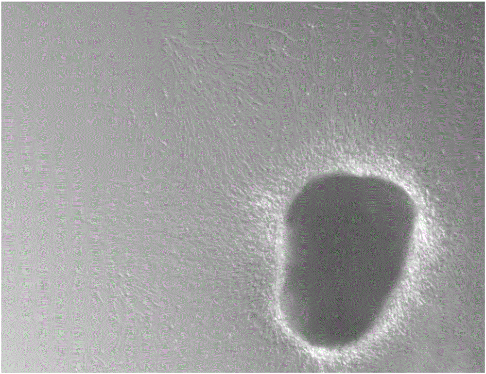 Isolated culture method for chicken embryo pulmonary arterial smooth muscle cells