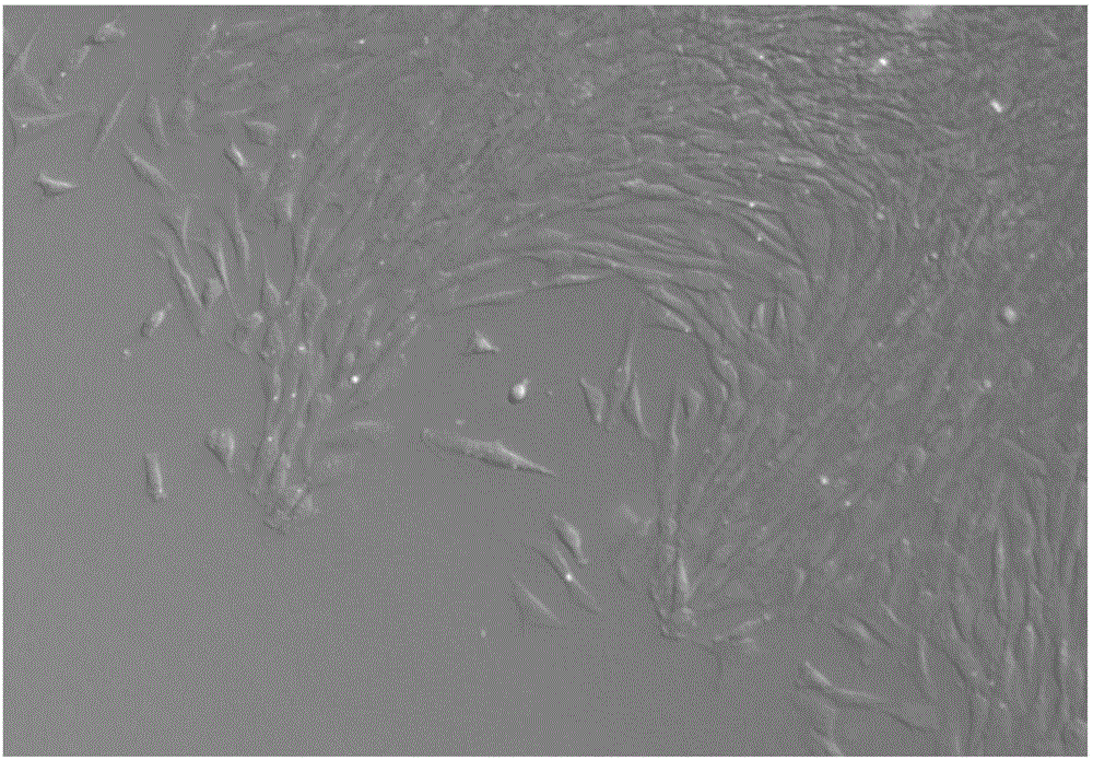 Isolated culture method for chicken embryo pulmonary arterial smooth muscle cells