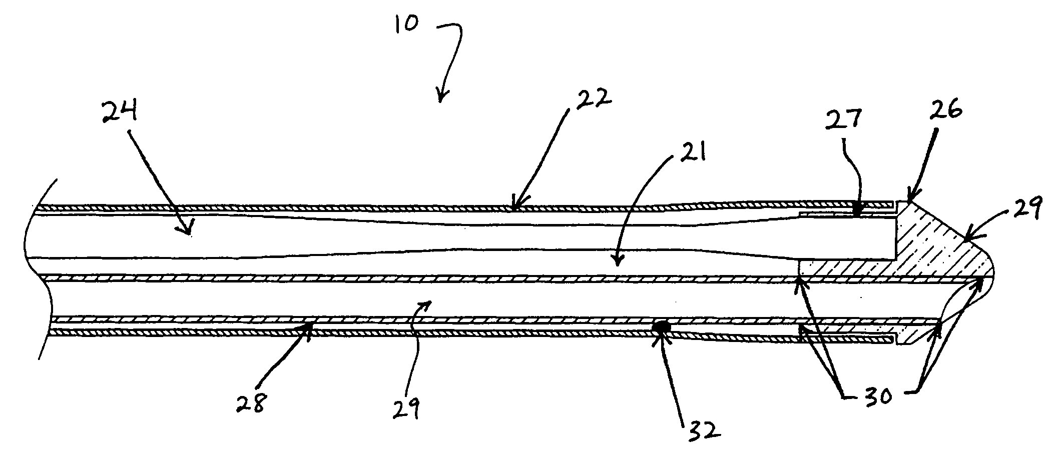 Ultrasound catheter for disrupting blood vessel obstructions