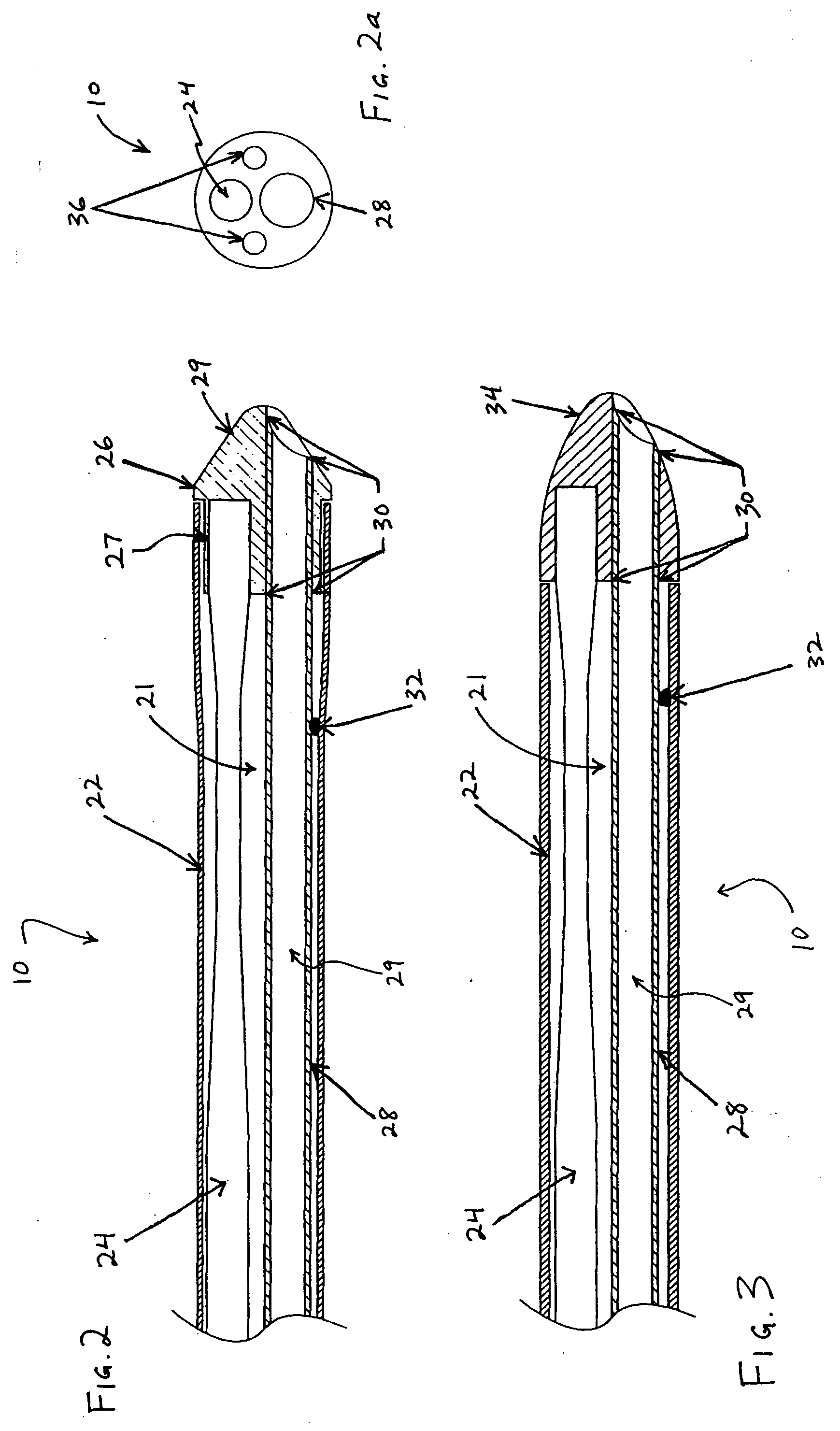 Ultrasound catheter for disrupting blood vessel obstructions