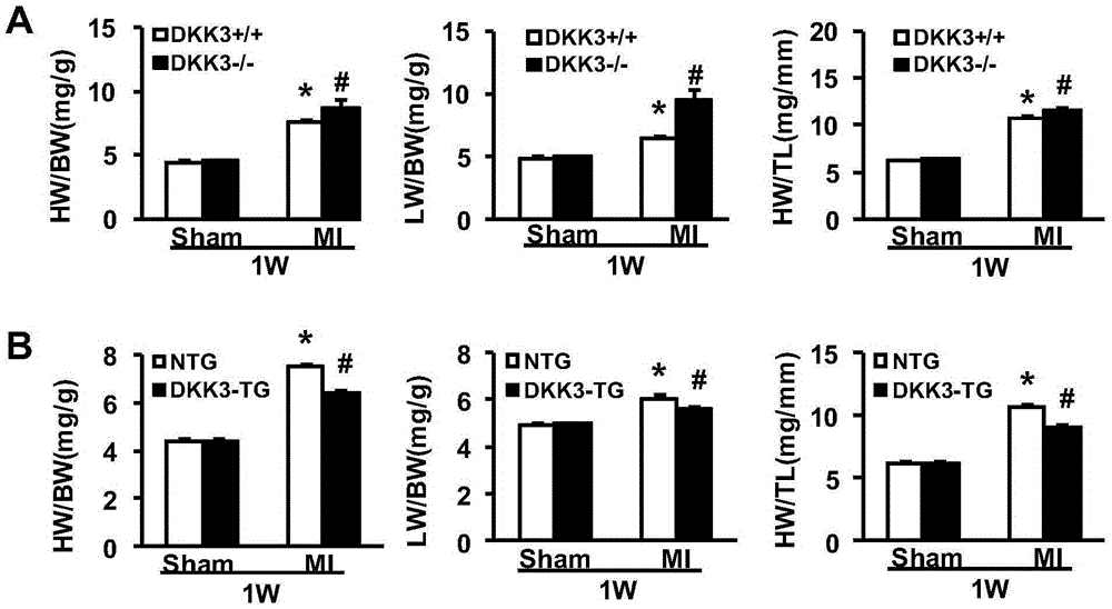 Function and application of dickkopf-3 (dkk3) gene in coronary atherosclerotic heart disease