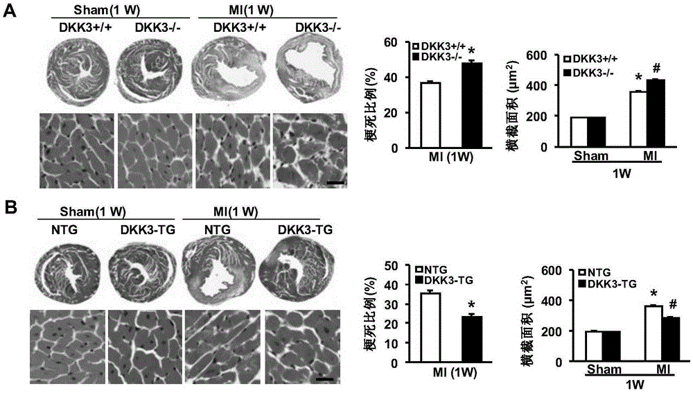 Function and application of dickkopf-3 (dkk3) gene in coronary atherosclerotic heart disease