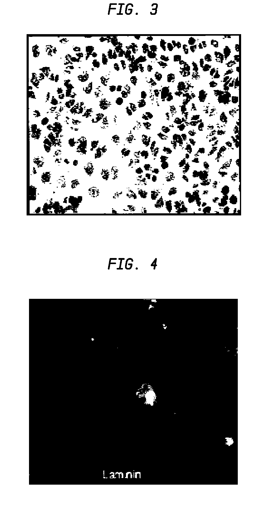 Nanosphere/microsphere delivery system for the treatment of spinal cord injury