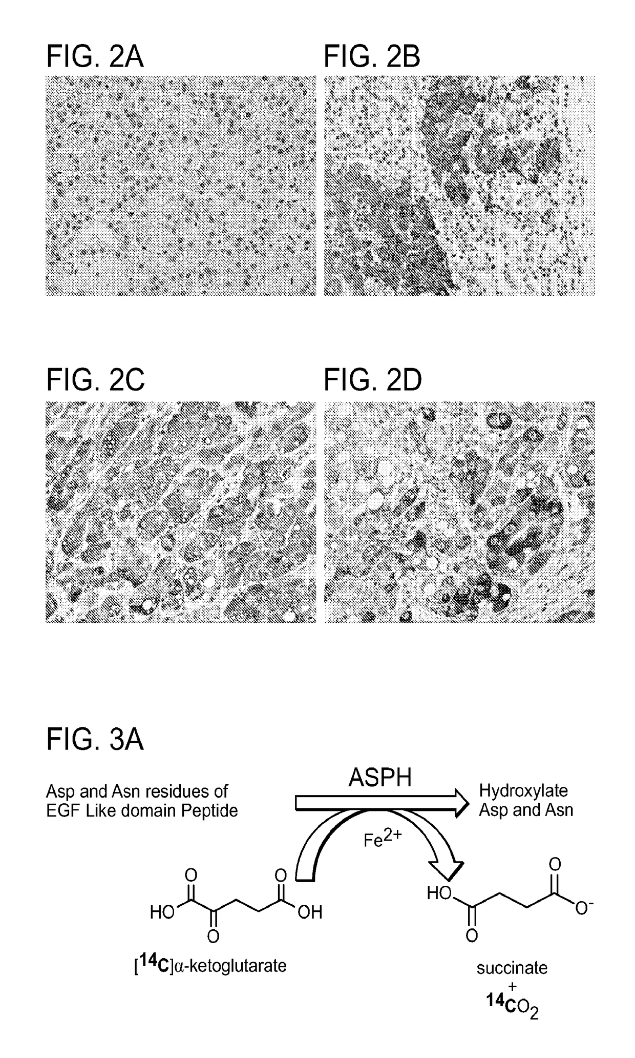 Inhibitors of beta-hydroxylase for treatment of cancer