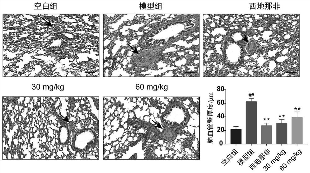 Application of polydatin in preparation of medicine for treating pulmonary arterial hypertension