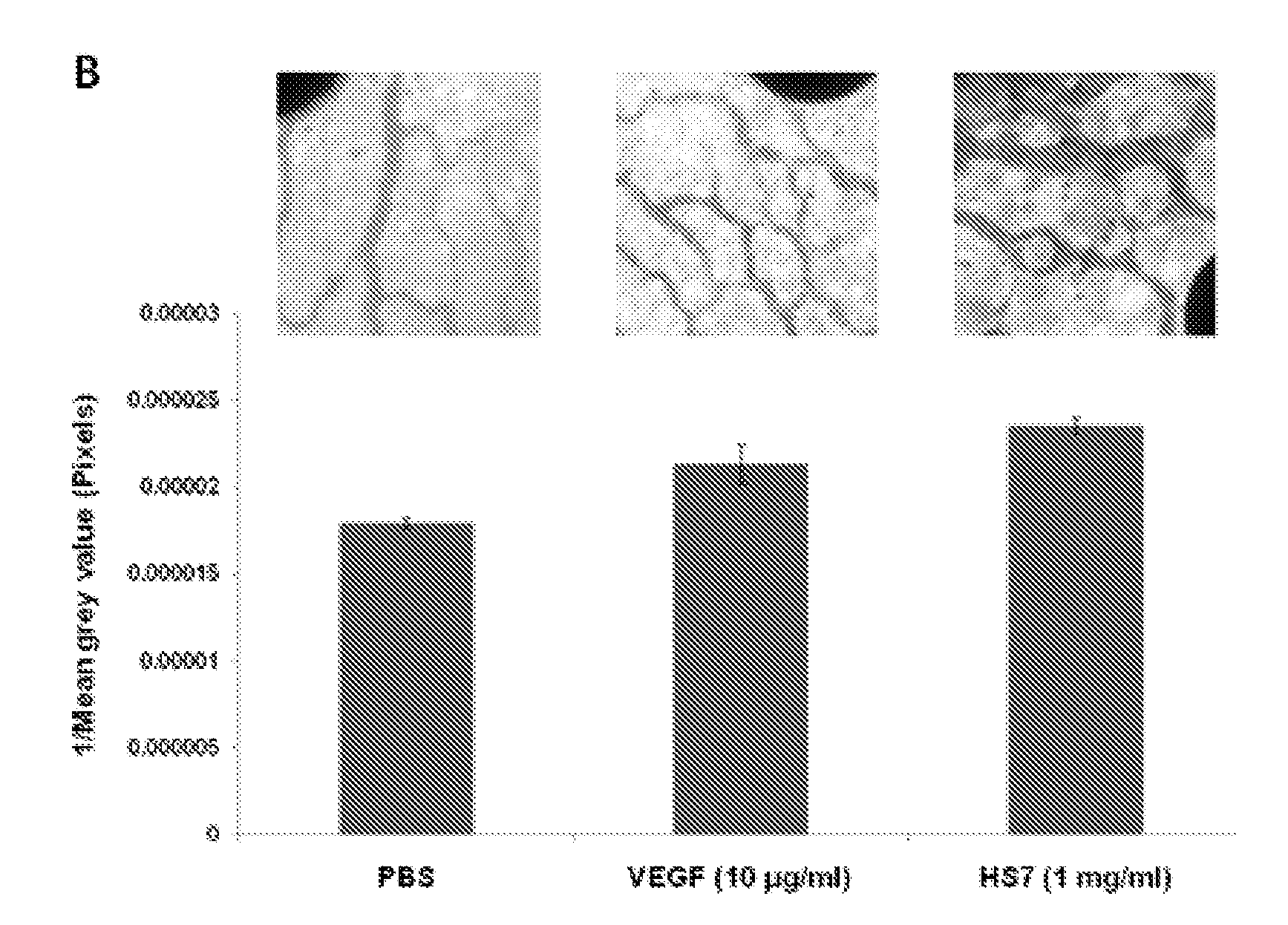 Glycosaminoglycans