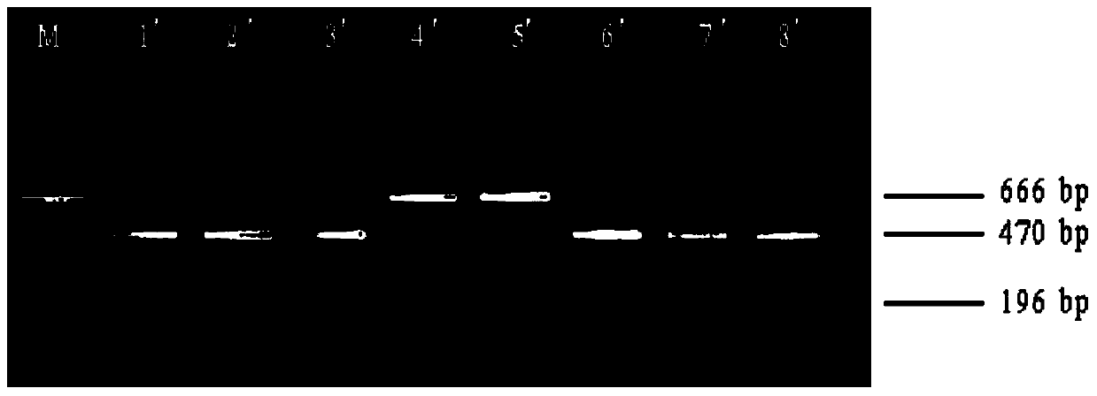 PCR-FRLP quick detecting method of common sturgeons