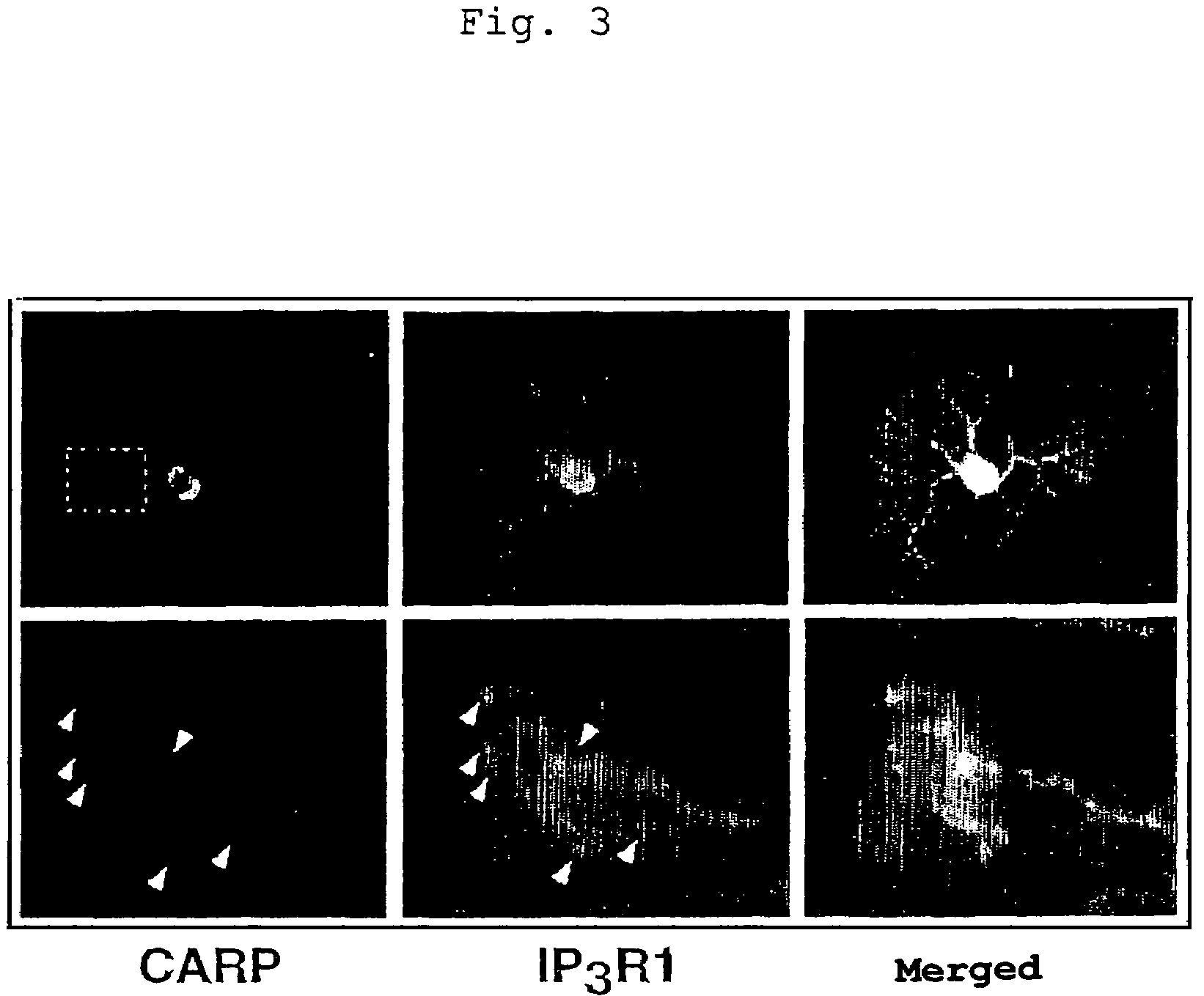 Control of function of intracellular Ca ion