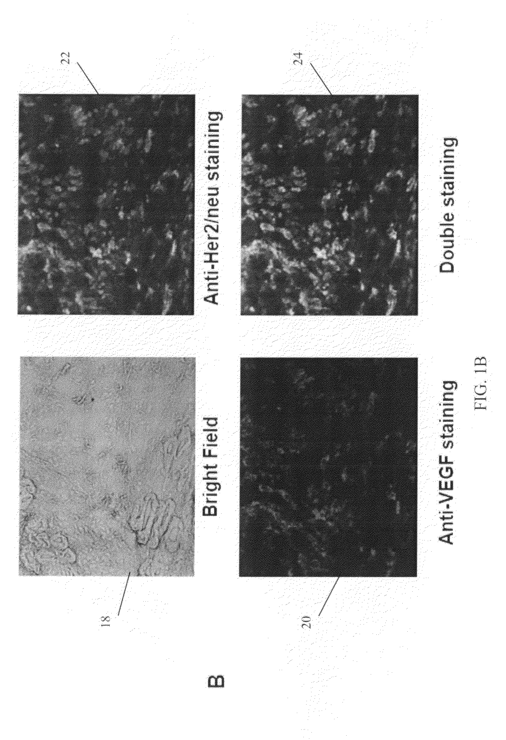 Therapeutic beta-glucan combinations