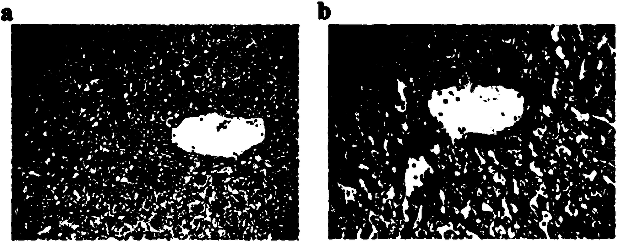 Application of mimic antigen compound in treatment of HBV infection related symptoms