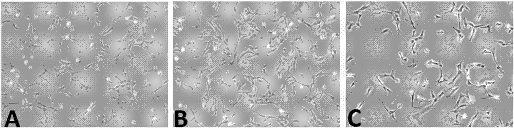 Reagent kit for primary culture on umbilical cord mesenchymal stem cells