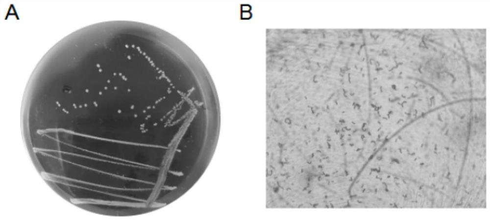 Lactobacillus plantarum P101 with high antioxidant activity and application thereof