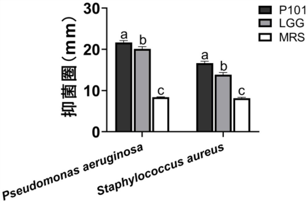 Lactobacillus plantarum P101 with high antioxidant activity and application thereof