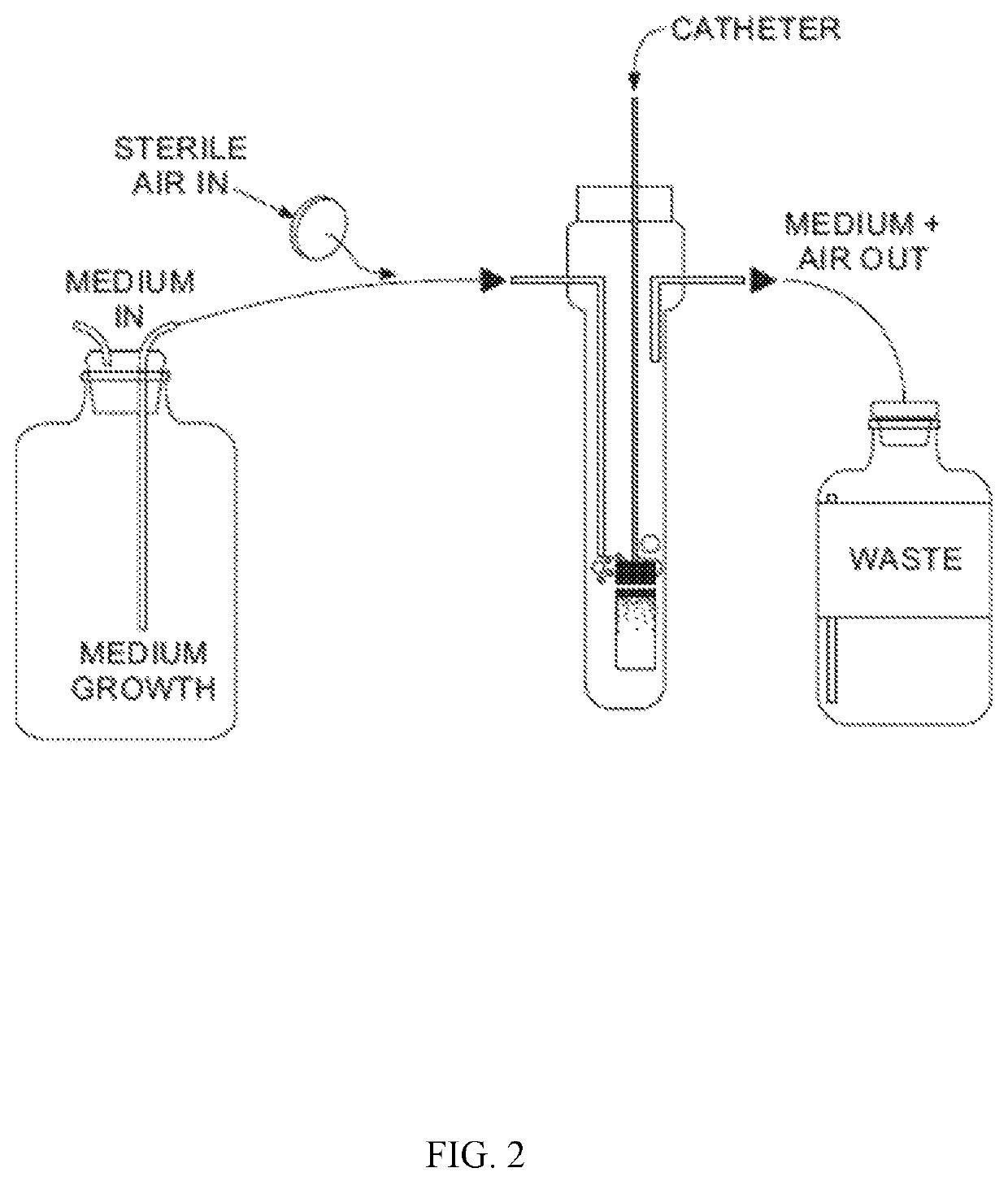 Catheter locking solution and catheter locking therapy