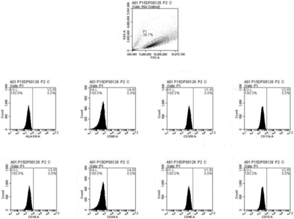 Stem cell exosome preparation, and preparation method and application thereof