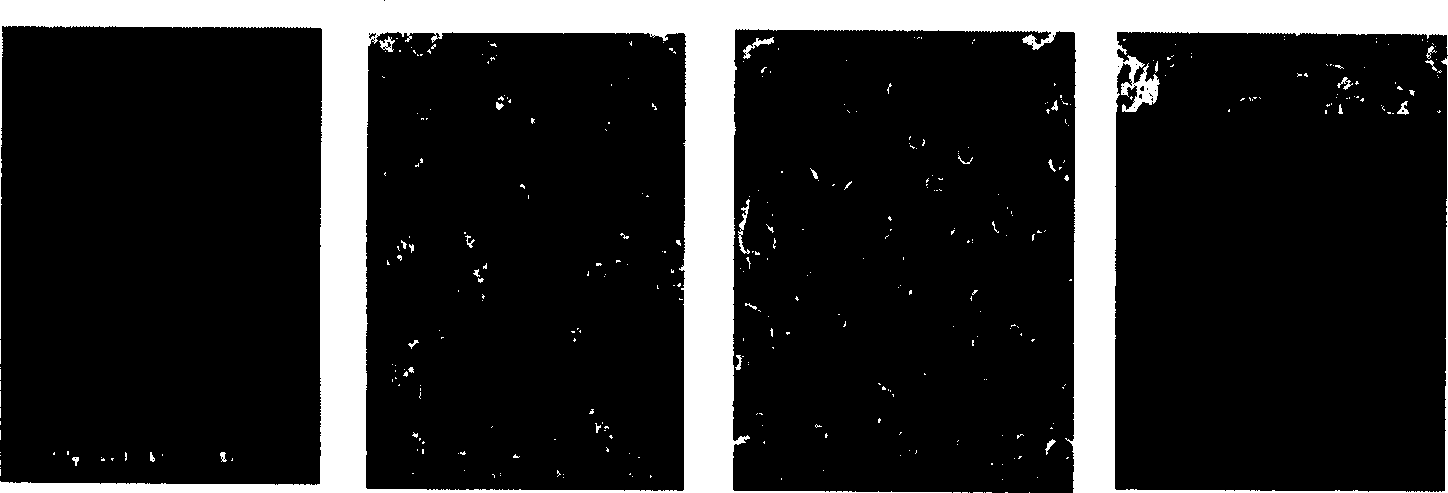 Degradable ternary poly-beta-hydroxy butyrate and its prepn.