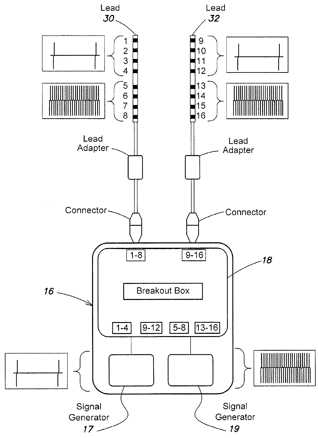 Method and apparatus for multimodal electrical modulation of pain